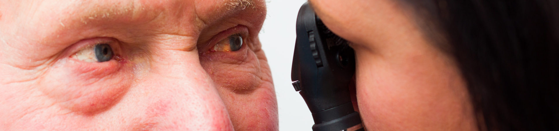 up close photo of a man getting a slit lamp eye exam