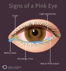 does unequal pupil size mean pink eye