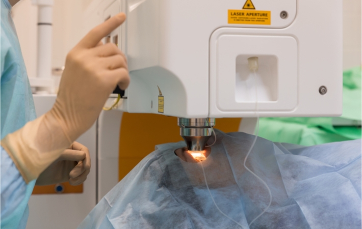 Opthalmologist operating a laser during eye surgery with patient laying covered in surgical drapes.