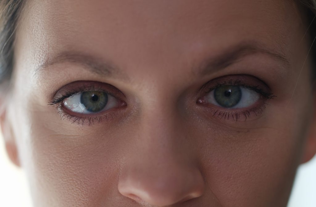 A close-up view of the blue eyes of a woman with her left eye wandering/turning