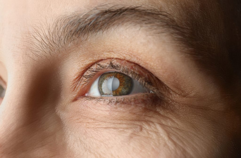A close up of an older woman that has developed cataracts
