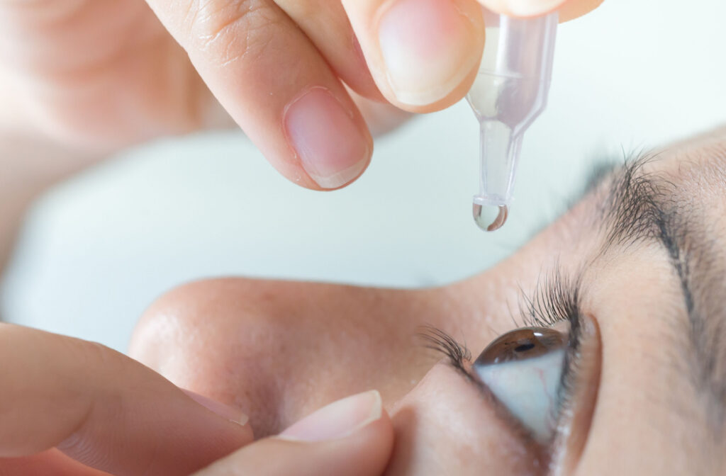 A close-up view of a young woman applying artificial tear drops on her left eye to relieve her eyes from burning sensation.