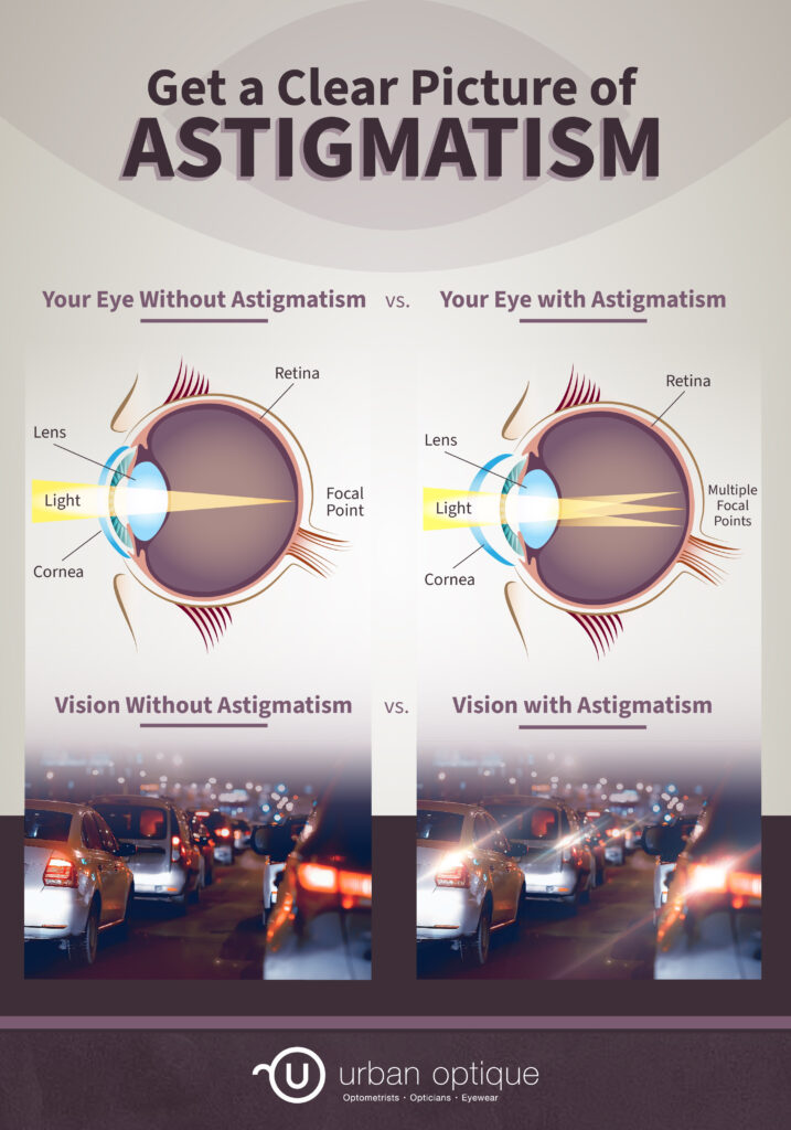 An infographic explaining vision gets blurry due to multiple focal points when you have astigmatism