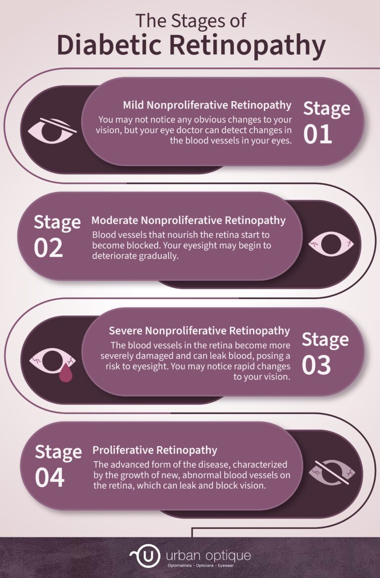 The 4 Stages of Diabetic Retinopathy | Urban Optique